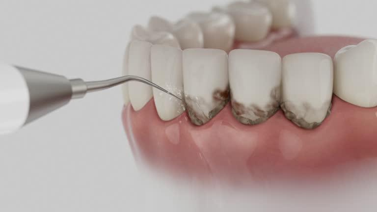 Trusted Tooth Extraction service in Front Royal, VA - Dentist Open Now